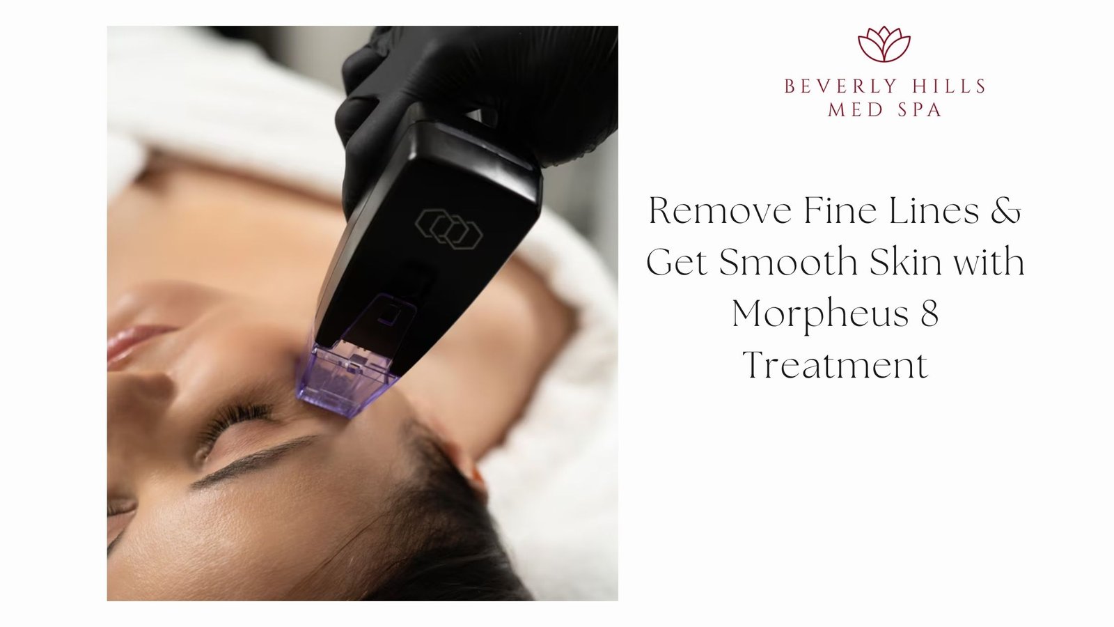 morpheus 8 treatment