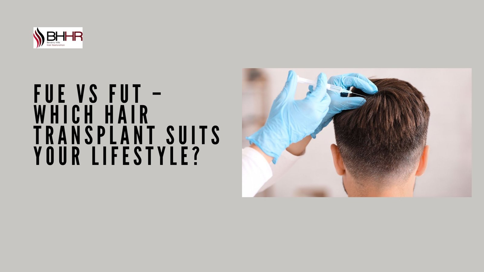 FUE vs FUT